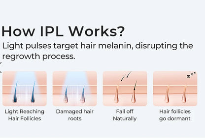 IPL Laser Hair Removal Device