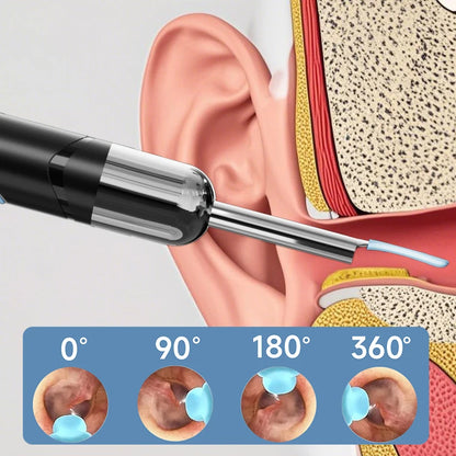 HD 1080P Visual Ear Cleaner with WiFi Camera