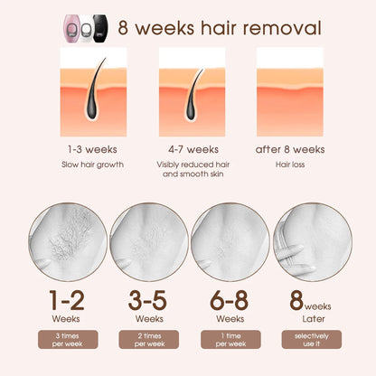 IPL Laser Hair Removal Device