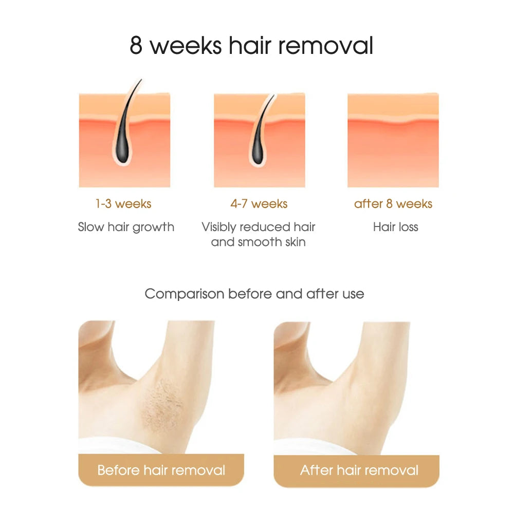 IPL Laser Hair Removal Device